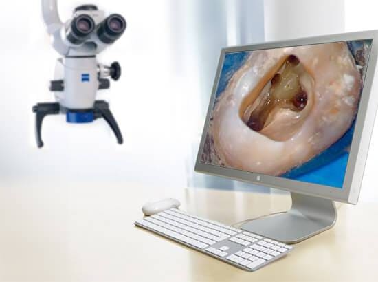 лечение зубов под микроскопом в Екатеринбурге